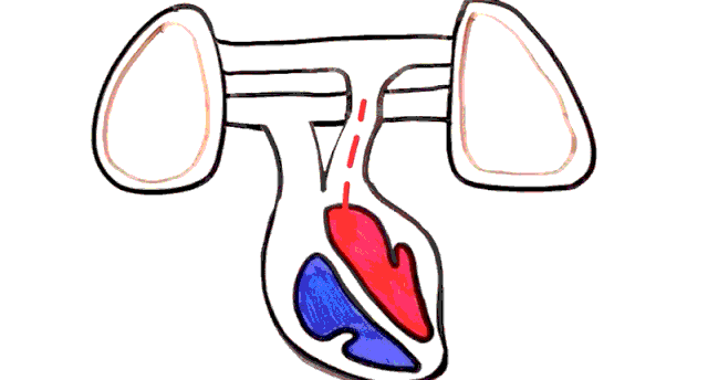 慢阻肺患者活动后有濒死感是否合并心衰主要看这两点症状