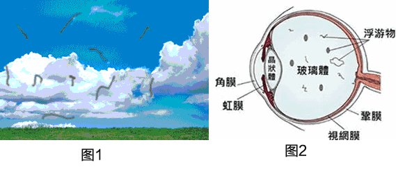 比起夏天的蚊子,挥之不去的"飞蚊症"更烦人!
