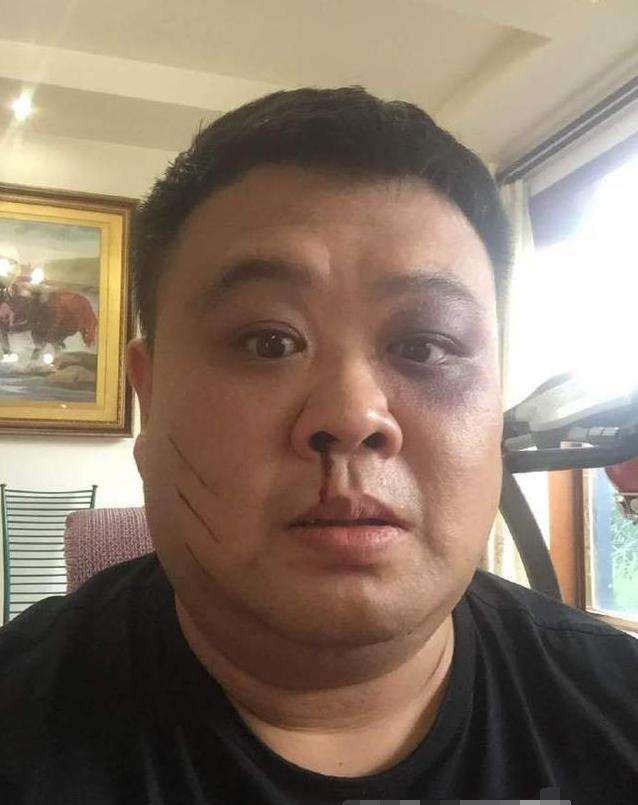 郭德纲,孙越,德云社,岳云鹏,三眼怪,纹身