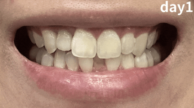 天天喝咖啡,有一个被忽视的坏处(不是失眠