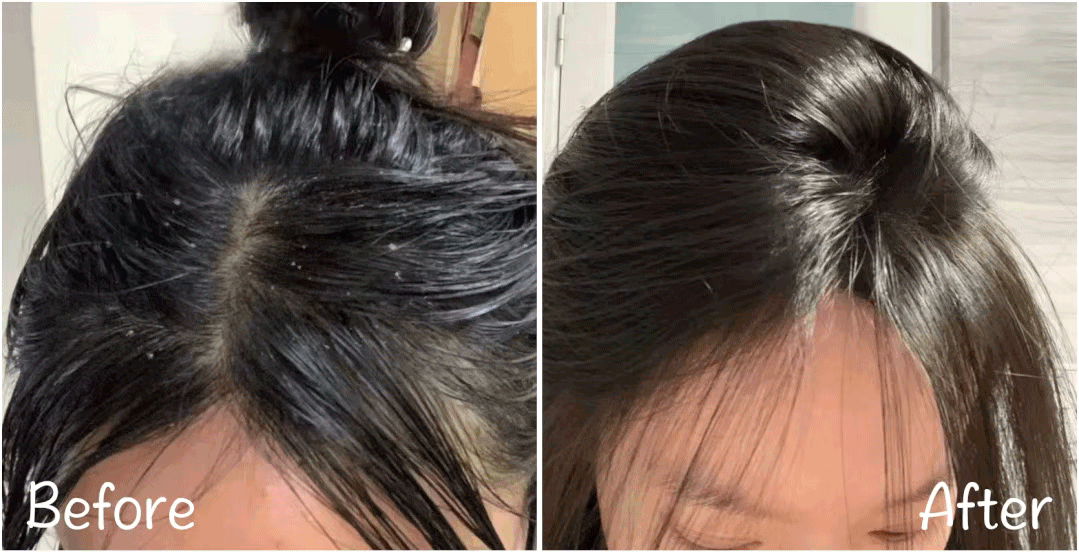 大油头?细软塌?掏心窝子种草神仙洗护!