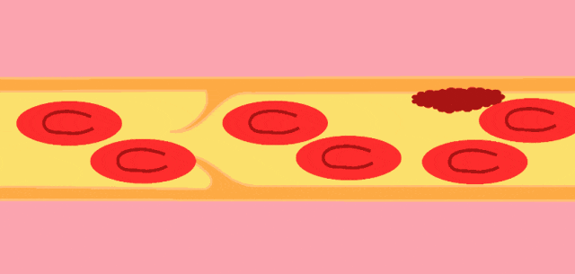 ͼƬ