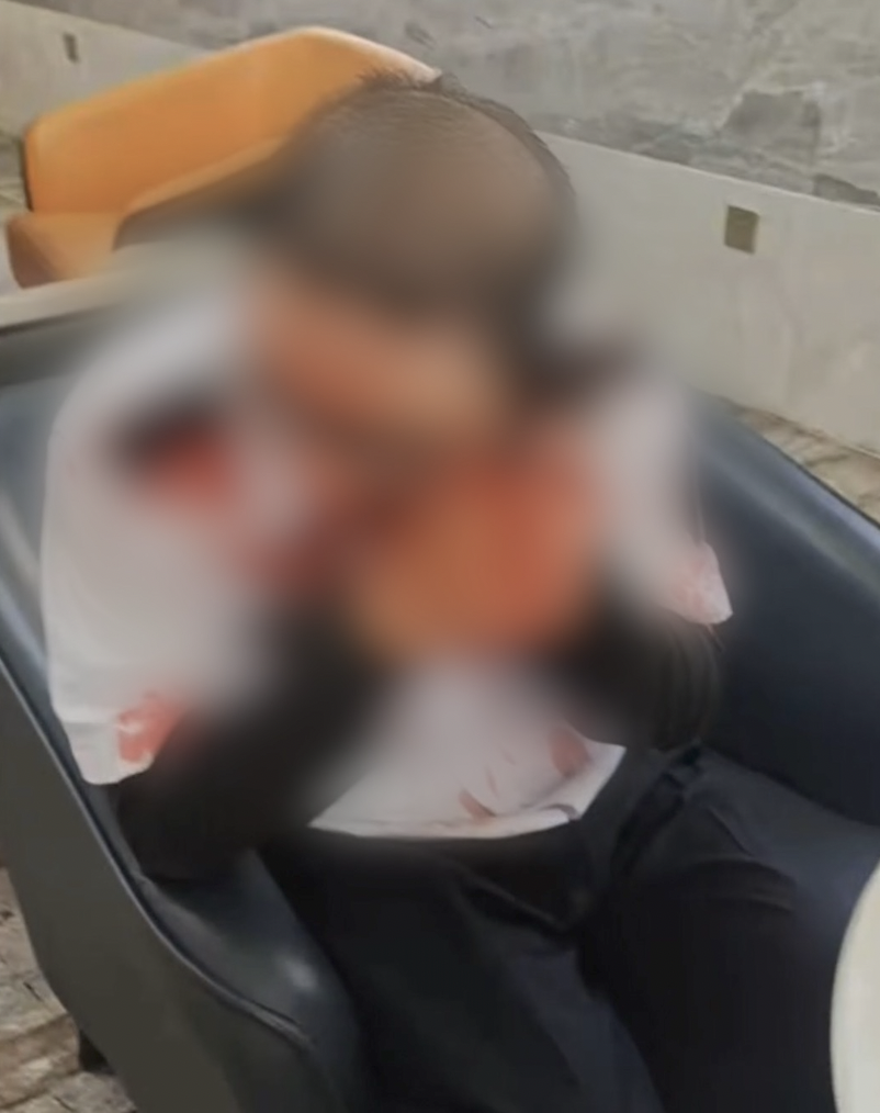 鼻口缝针、脑部疑有淤血！温州保安代送外卖遭业主疯狂踢打