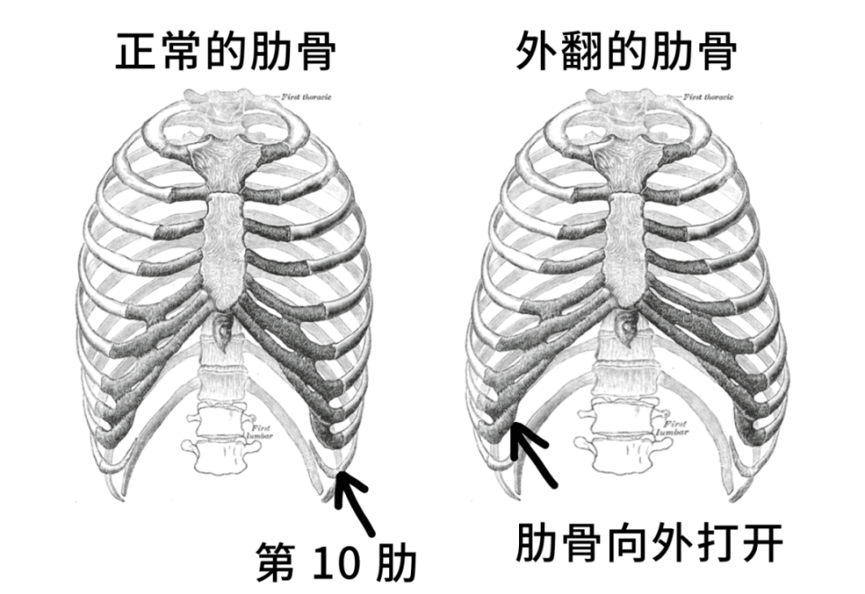 肋骨是保护胸腔脏器的重要结构,它