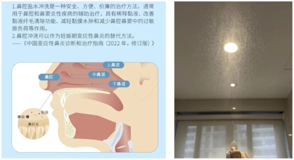 海水鼻腔喷雾器怎么用我们最近又买了 5 个好用的「新玩意」_https://www.jmylbn.com_新闻资讯_第14张