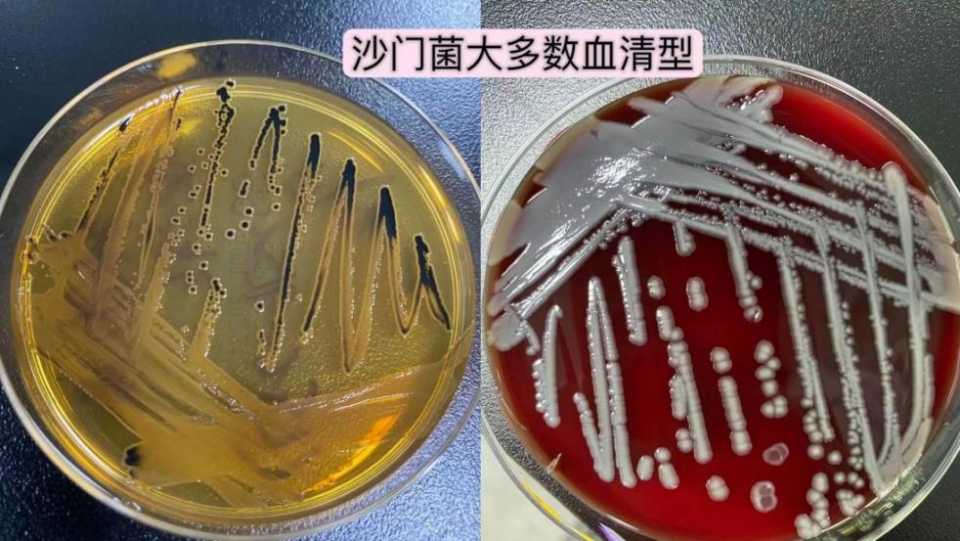 孩子发热,呕吐,拉肚子,元凶竟是"沙门氏菌"!