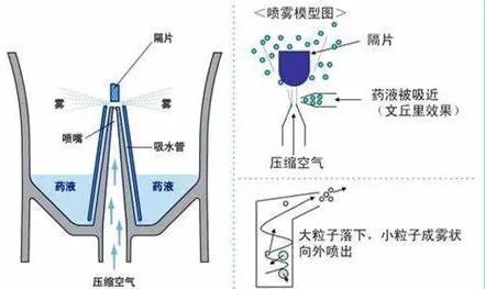 压缩式雾化器怎么用数百块的雾化器和上千块的雾化器，哪个更好？_https://www.jmylbn.com_新闻资讯_第2张