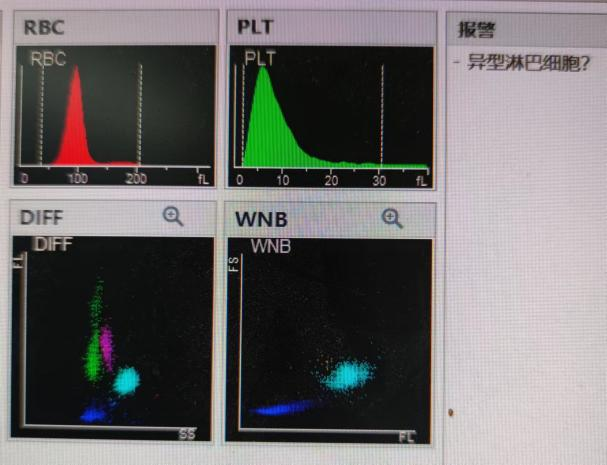 尿沉渣仪器怎么使用检验报告审核“十大坑”！90%的检验人都逃不掉..._https://www.jmylbn.com_新闻资讯_第1张