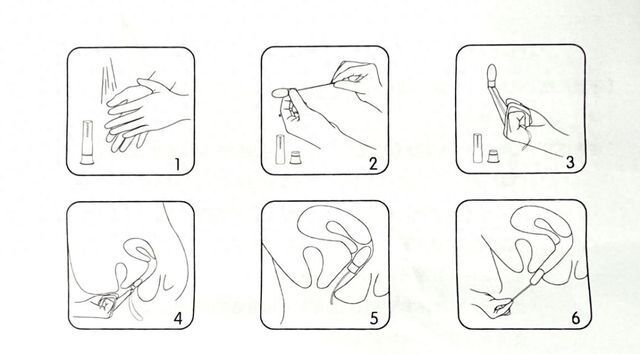 每日一药外用抗真菌药克霉唑阴道膨胀栓