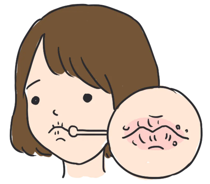 给你的牙齿"改斜归正"!盘点矫牙过程常见问题