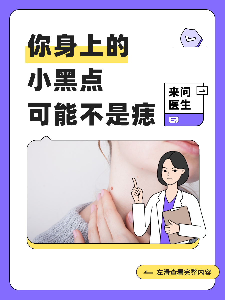 身上的小黑点不一定都是痣,有一种竟会癌变!