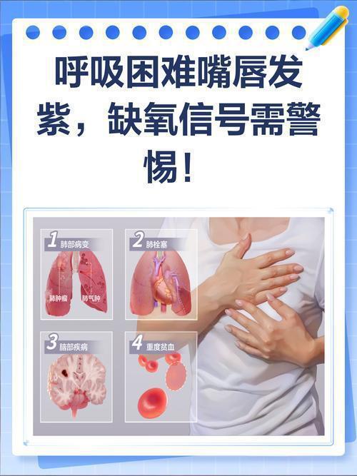 为什么制氧机要加水家庭制氧机怎么选？实测揭秘高性价比品牌推荐！_https://www.jmylbn.com_新闻资讯_第2张