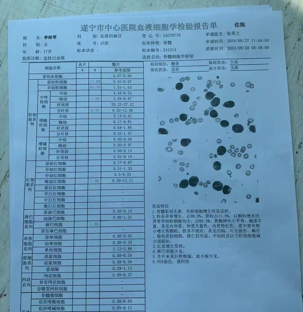 巨型血小板图片