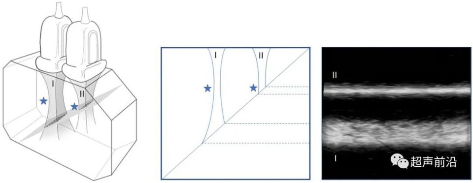 ge医疗器械怎么样GE vs 飞利浦 vs Butterfly ： 手持超声参数差异对比_https://www.jmylbn.com_新闻资讯_第4张
