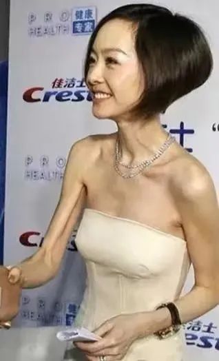 在"10粒米减肥法"的作用下,陈鲁豫从原来的120斤瘦到了差不多80斤.