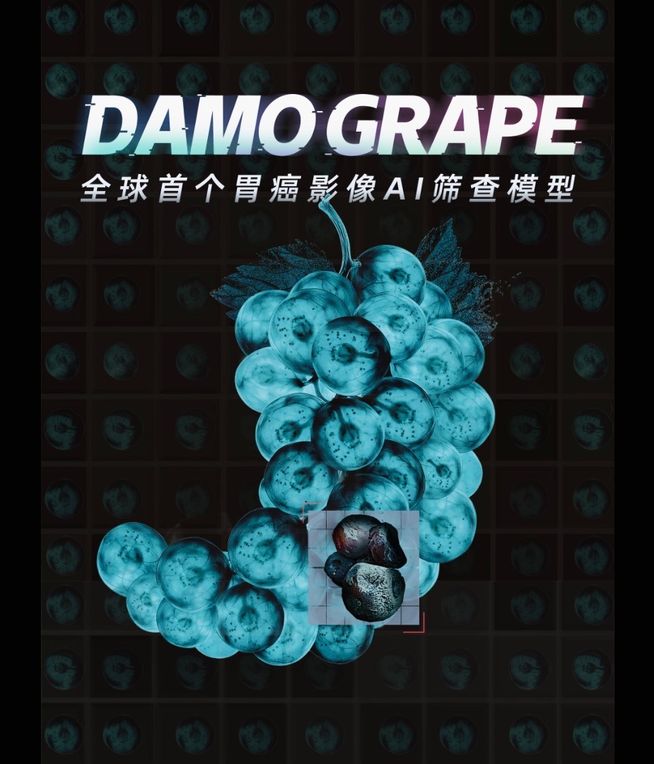 重磅！全球首个胃癌影像筛查AI模型问世，能大幅提升检出率？