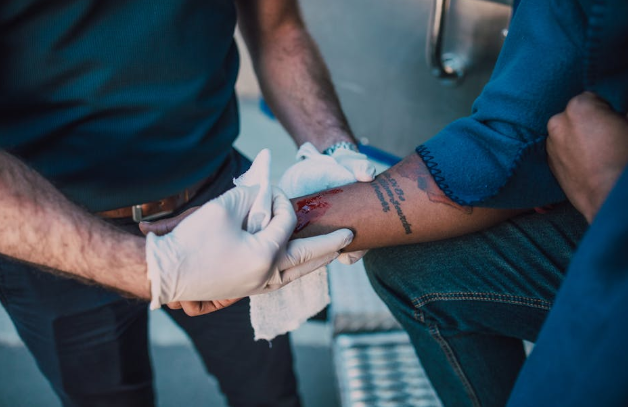 创伤胶有哪些10秒内瞬息止血！外伤“大出血”救命凝胶获批_https://www.jmylbn.com_新闻资讯_第7张