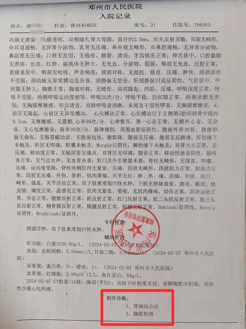 据邓州市人民医院出具的病历资料显示:入院诊断为肾病综合征,胸腔积液