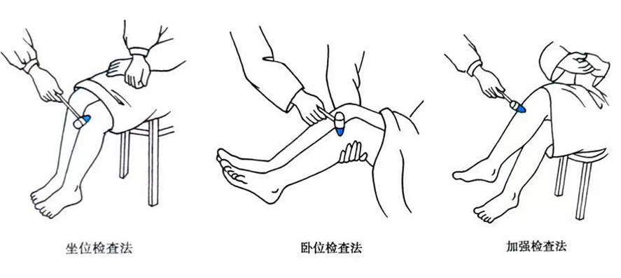 检查者以左手托起其膝关节使之屈曲约120°,用右手持叩诊锤叩击膝盖