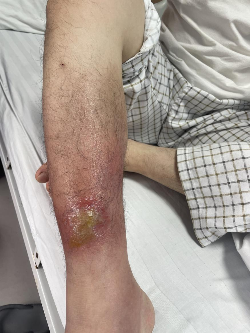 夏天做这些事,要当心