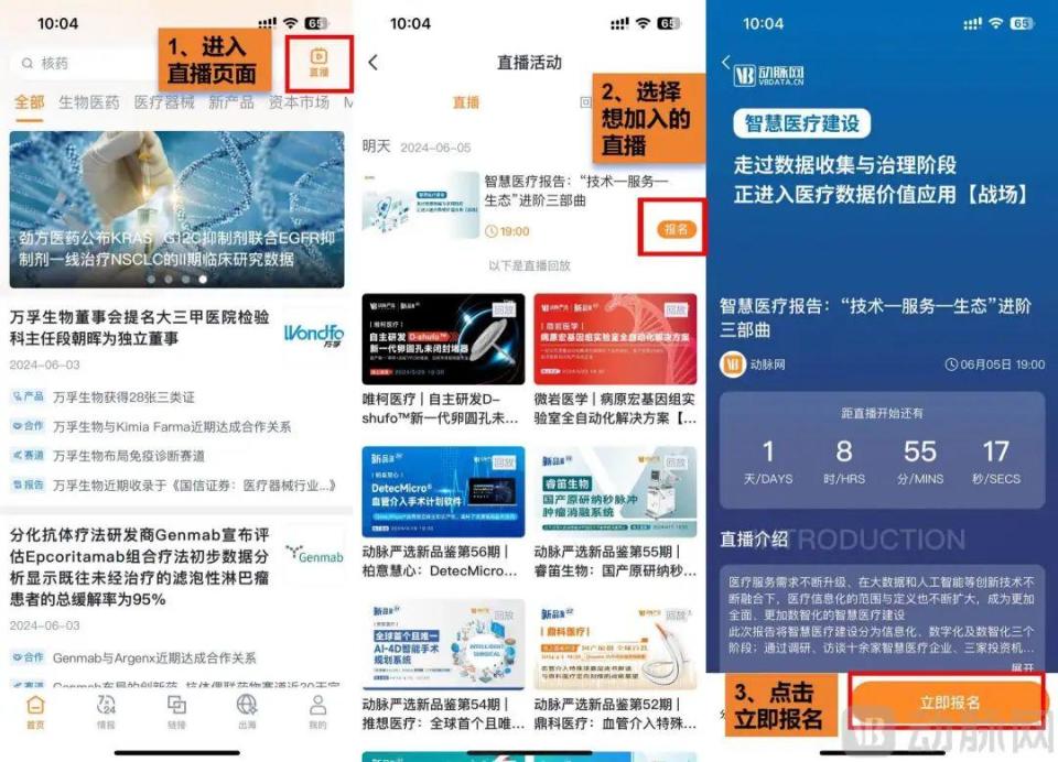 tms什么医疗今晚直播：精密神经导航经颅磁(TMS)【曦嘉医疗｜动脉新品鉴127期】_https://www.jmylbn.com_新闻资讯_第5张