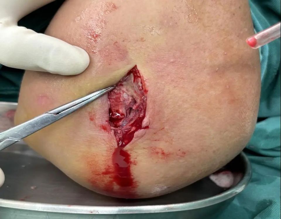 海鲜市场的隐形杀手