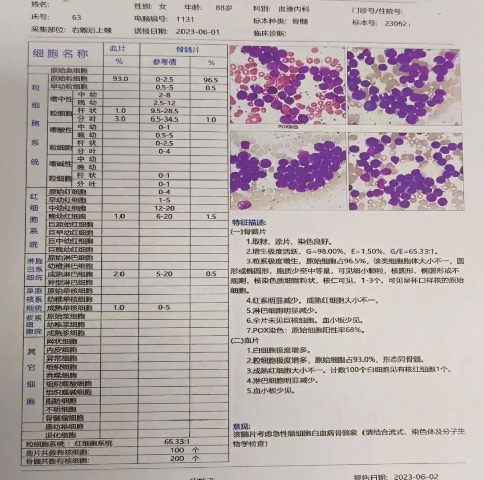 外周血涂片报告图片