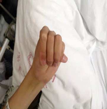 致命的大脚她怎么也没想到43码的脚竟然是种病