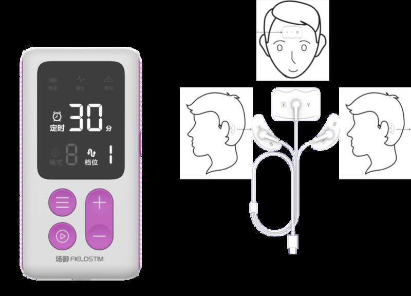 经颅电刺激仪怎么用我国首个国产强交流电经颅刺激仪获批 原发性失眠治疗有新突破_https://www.jmylbn.com_新闻资讯_第1张