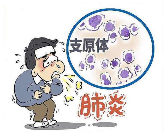 注意小儿高烧咳嗽不止小心得了支原体肺炎
