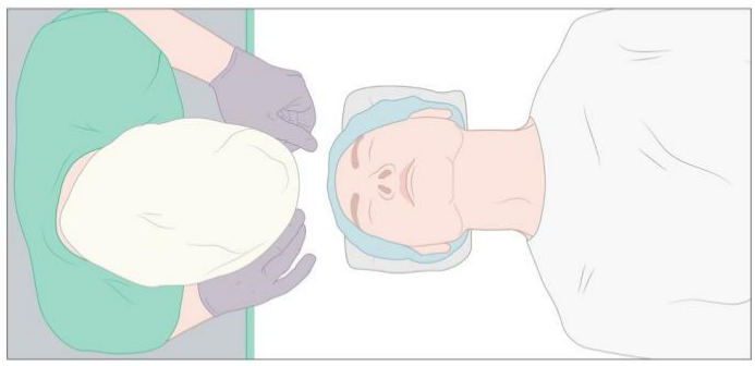 气管插管牙垫怎么放气管插管详细步骤（附多图）_https://www.jmylbn.com_新闻资讯_第5张