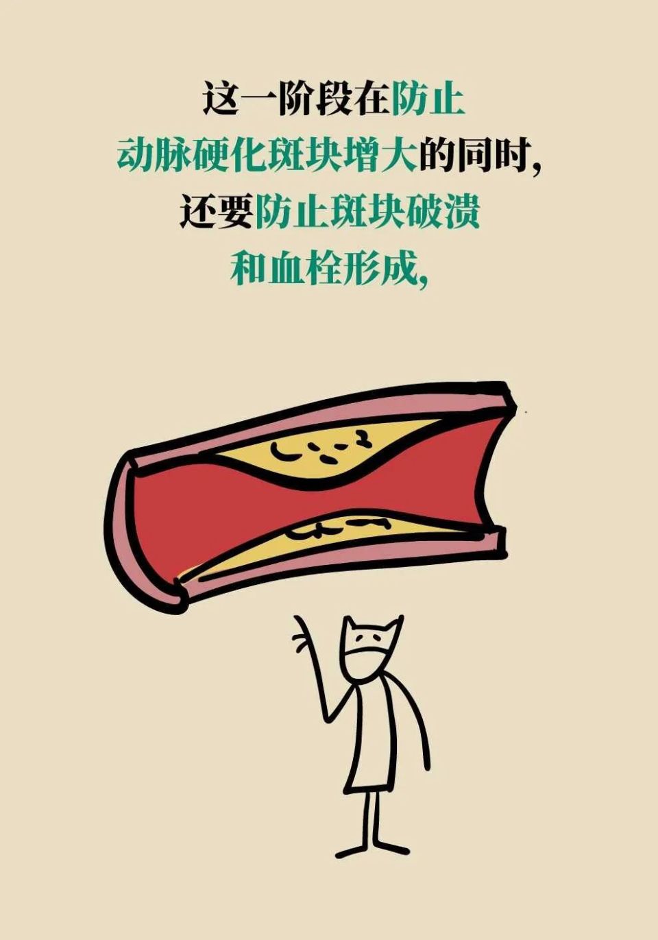 动脉硬化斑块分"三步"来袭,"各个击破"可预防卒中发生