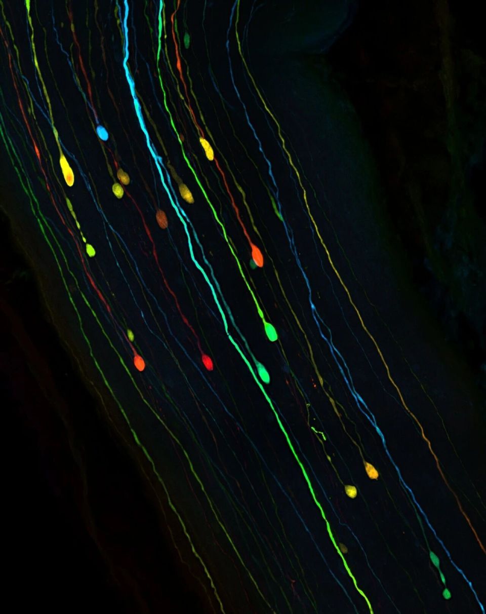 小鼠脑定位怎么固定追问daily ｜ 我们又搞错了？神经元断线后，靠的是物理重组，不是电活动！人格特质能预测一个人的死亡_https://www.jmylbn.com_新闻资讯_第3张