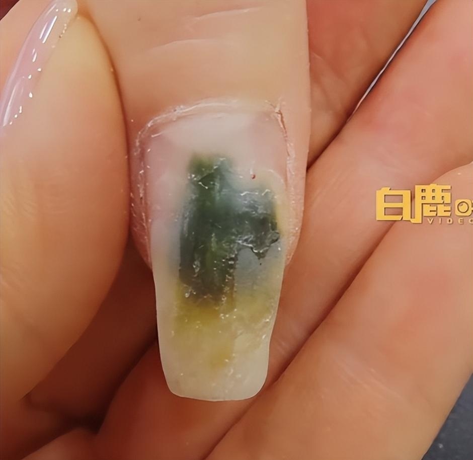 公开资料显示,绿脓杆菌,又称铜绿假单胞菌,是一种令免疫受损的机会性