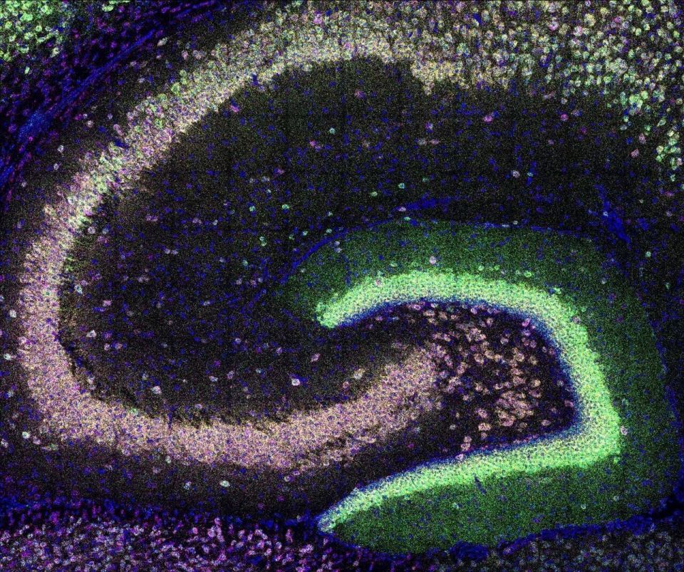 小鼠脑定位怎么固定追问daily ｜ 我们又搞错了？神经元断线后，靠的是物理重组，不是电活动！人格特质能预测一个人的死亡_https://www.jmylbn.com_新闻资讯_第2张