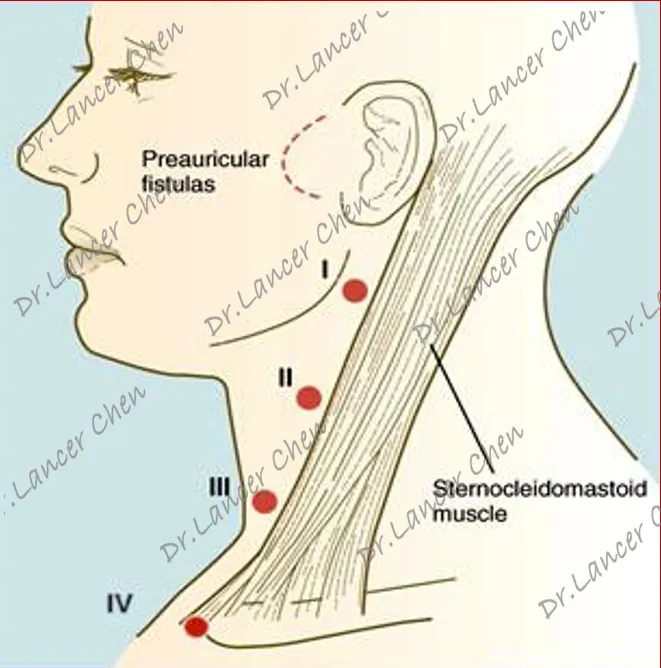 宝宝一感冒颈部就冒肿块警惕梨状窝瘘