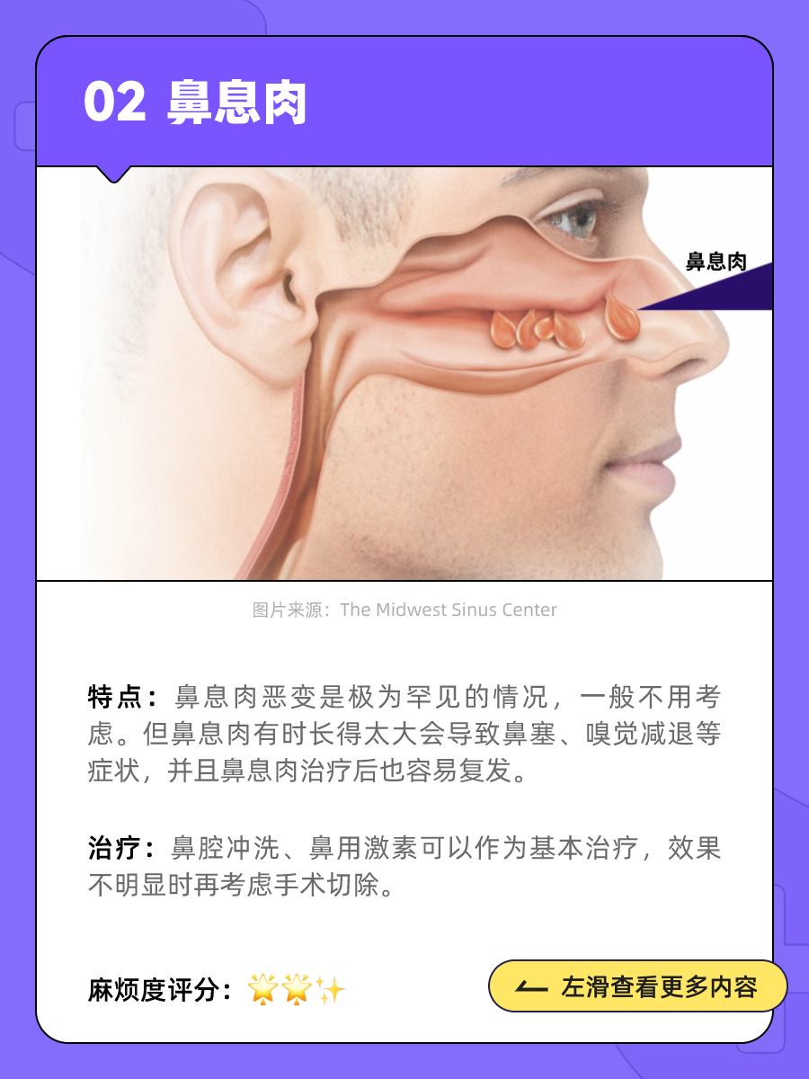 体检查出息肉,要紧吗?