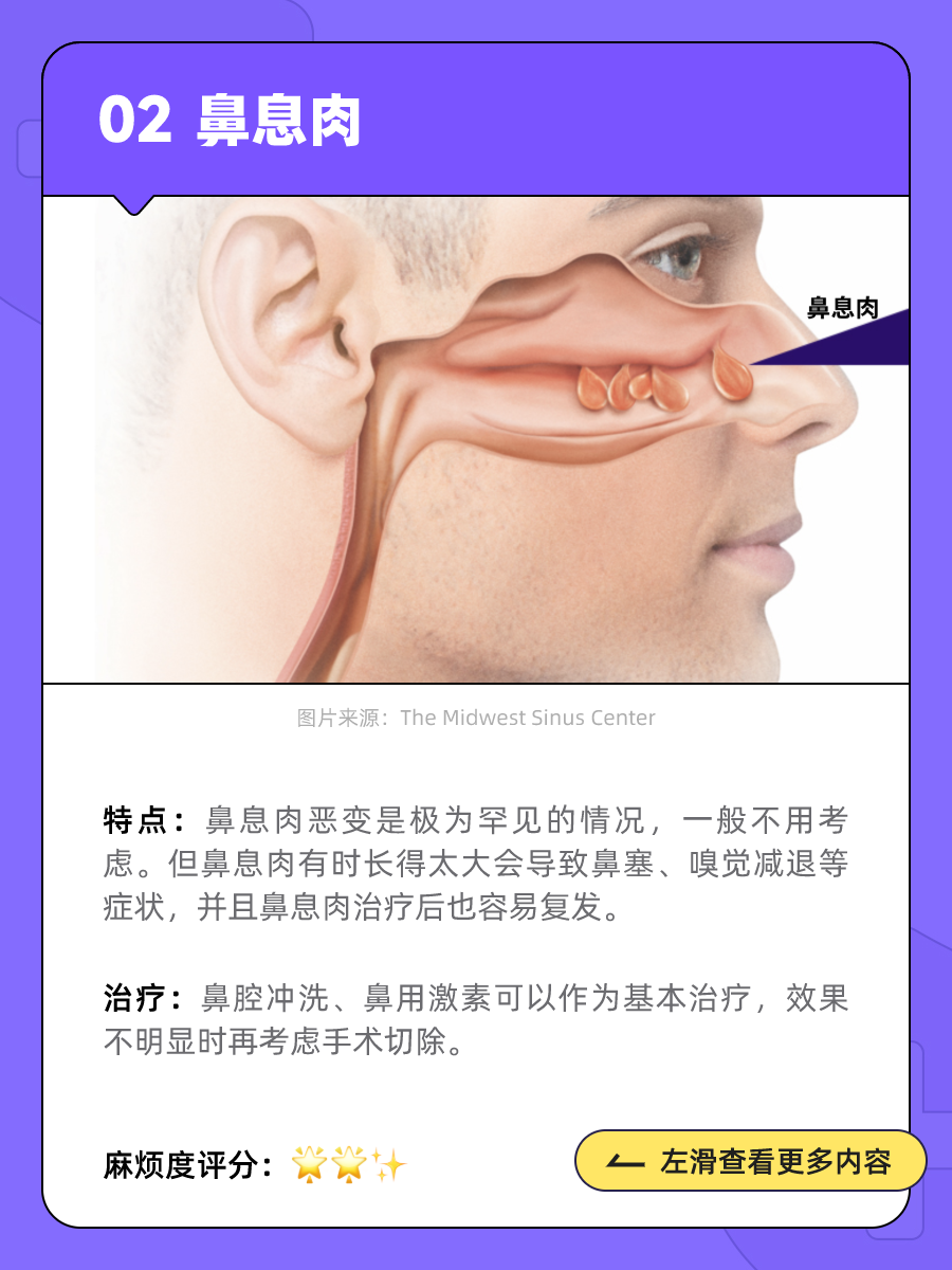 为什么会长鼻息肉图片