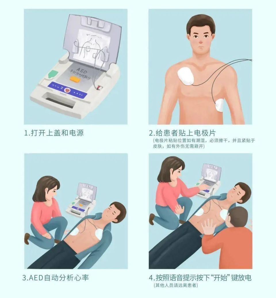 急救科普 | 心肺复苏(cpr)全攻略