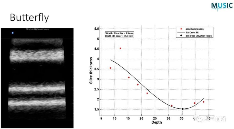 ge医疗器械怎么样GE vs 飞利浦 vs Butterfly ： 手持超声参数差异对比_https://www.jmylbn.com_新闻资讯_第7张
