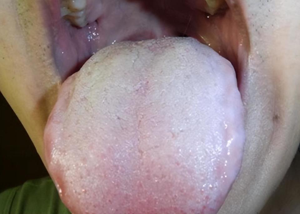 身体有病,舌头先"报警"!3种舌象抓紧调,要注意第3种_腾讯新闻