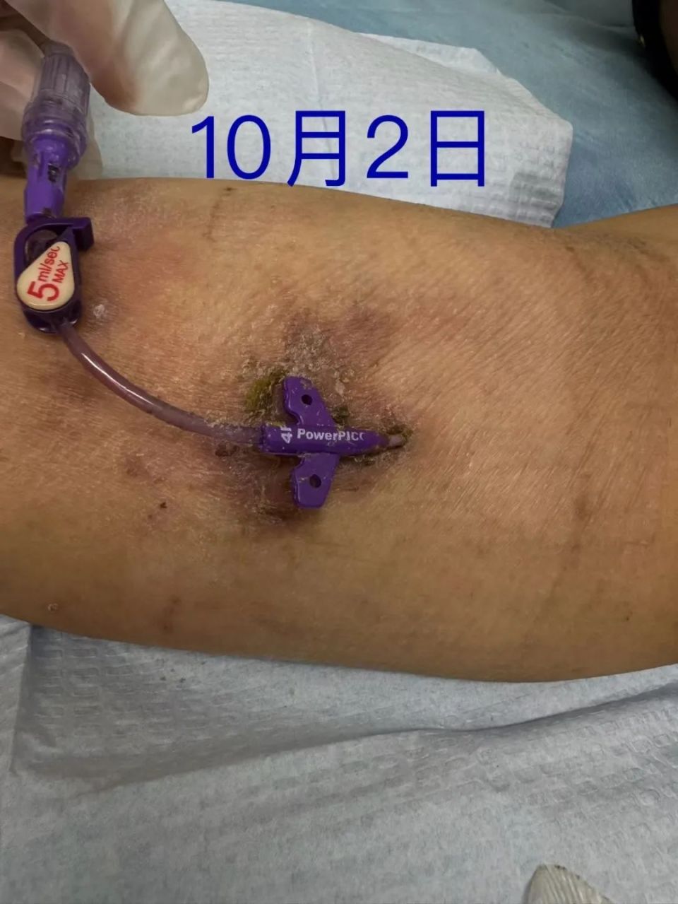 记南桥镇社区卫生服务中心picc专科门诊