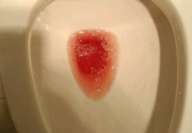 包括尿液的颜色,气味和量的变化.