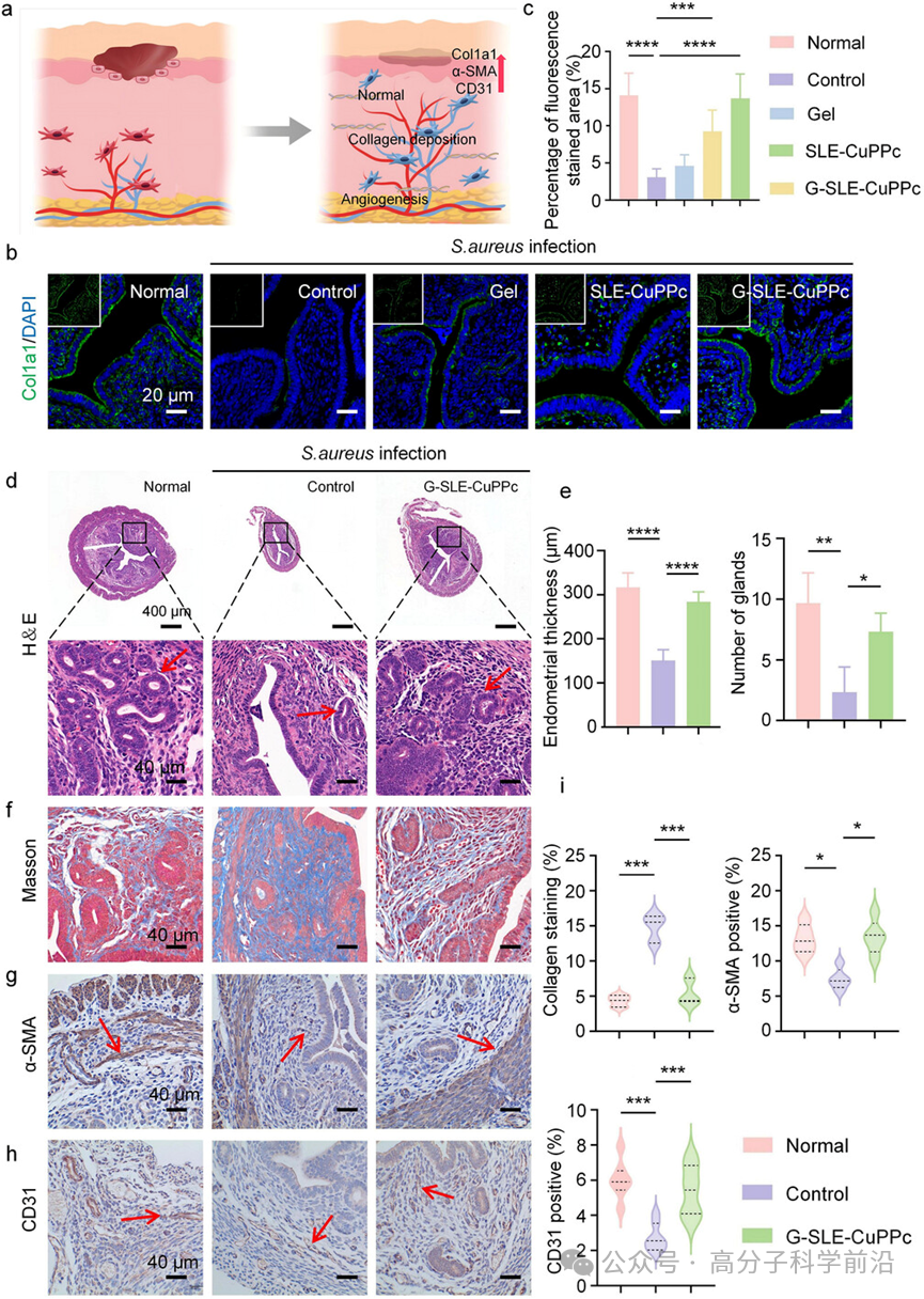 抗菌水凝胶怎么操作四川大学马朗、程冲、罗红团队《AFM》可注射刺状人工过氧化物酶复合水凝胶，用于生物适应性和协同对抗子宫内膜感染_https://www.jmylbn.com_新闻资讯_第7张