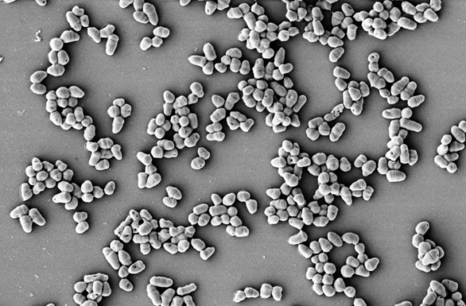 在工业领域,谷氨酸棒状杆菌用于合成生产食品调味料,防晒霜等一系列