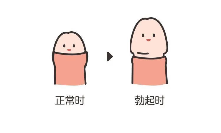 但很多宝宝的小 jj 不是这样的常见的主要有以下两种:假性包茎可理解