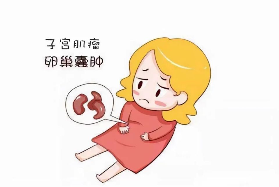 直播预告 | 子宫肌瘤与囊肿解密