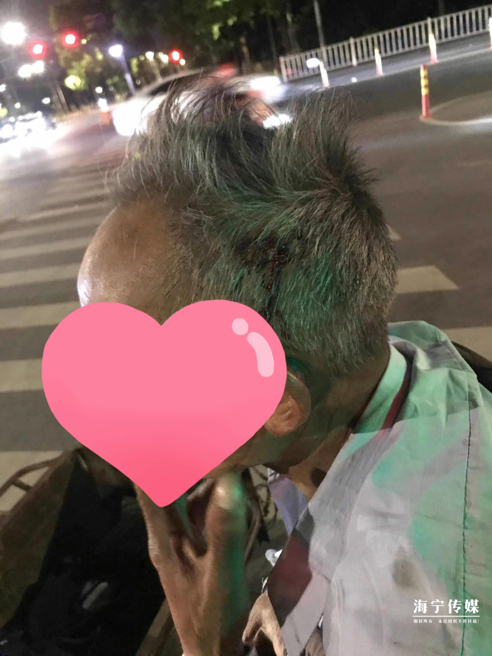 74岁老人头部流血,徘徊在海宁街头……发生了什么?