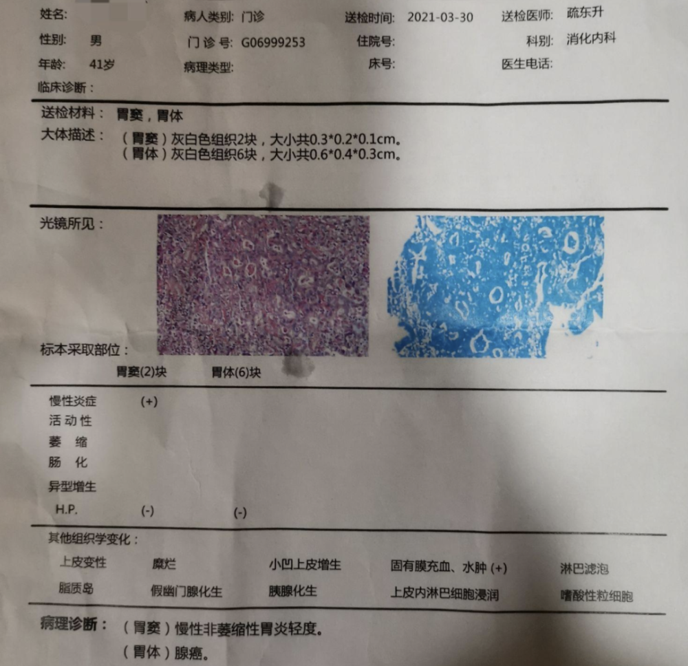 癌症晚期单子照片图片