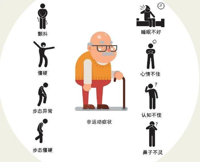 帕金森初期症状有哪些?_腾讯新闻